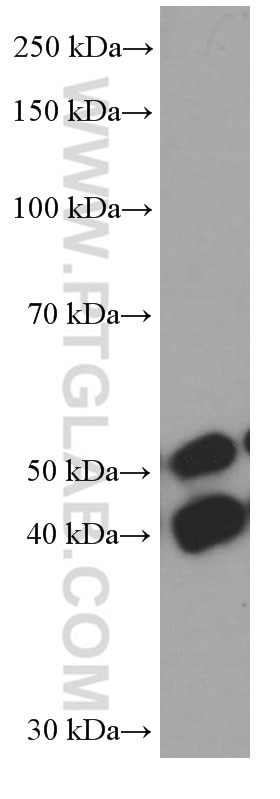 Western Blot (WB) analysis of HeLa cells using JNK Monoclonal antibody (66210-1-Ig)