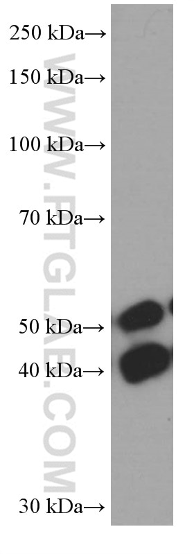 WB analysis of HeLa using 66210-1-Ig