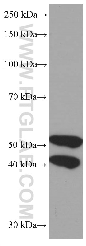 Western Blot (WB) analysis of RAW 264.7 cells using JNK Monoclonal antibody (66210-1-Ig)