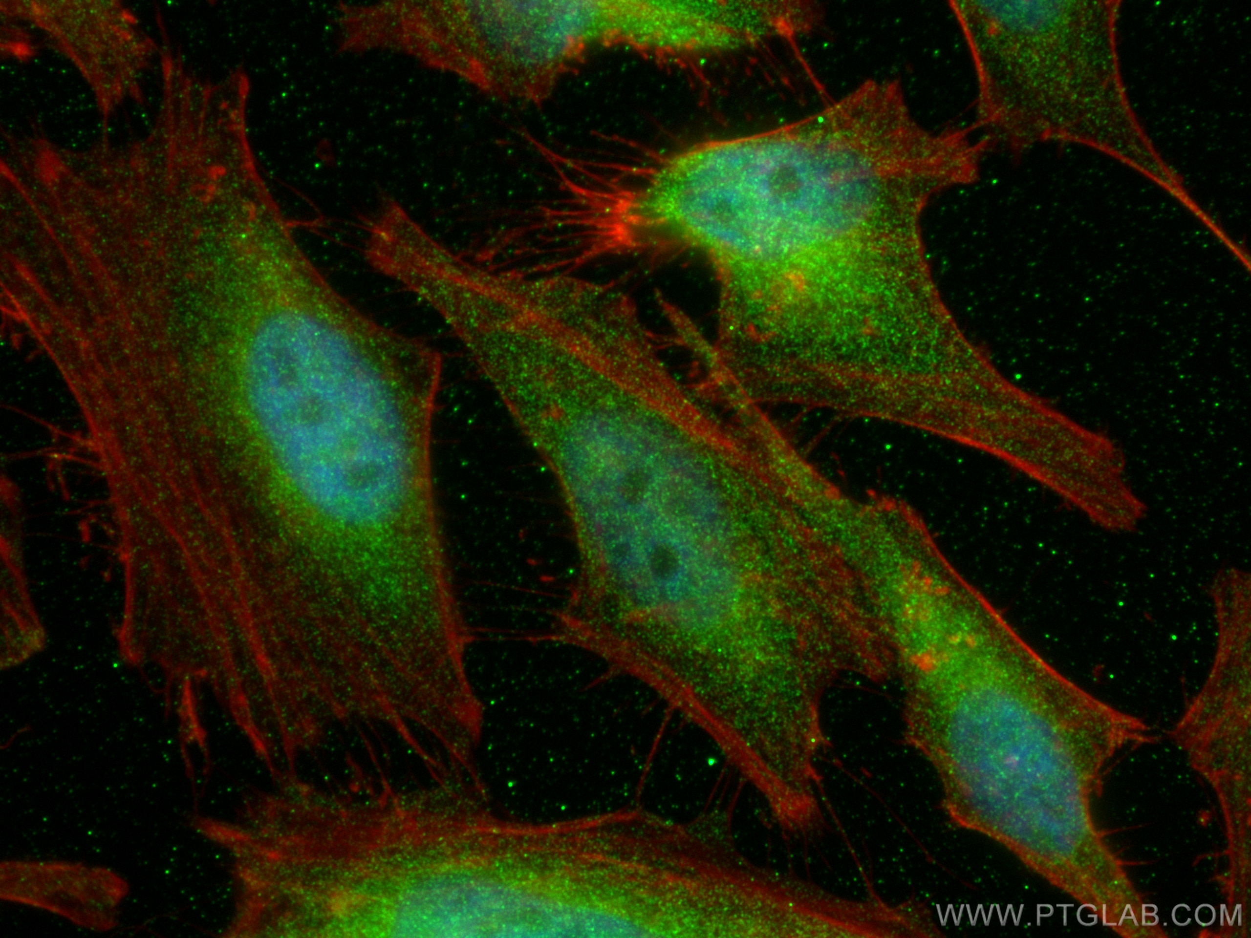 Immunofluorescence (IF) / fluorescent staining of HeLa cells using JNK Recombinant antibody (81629-1-RR)
