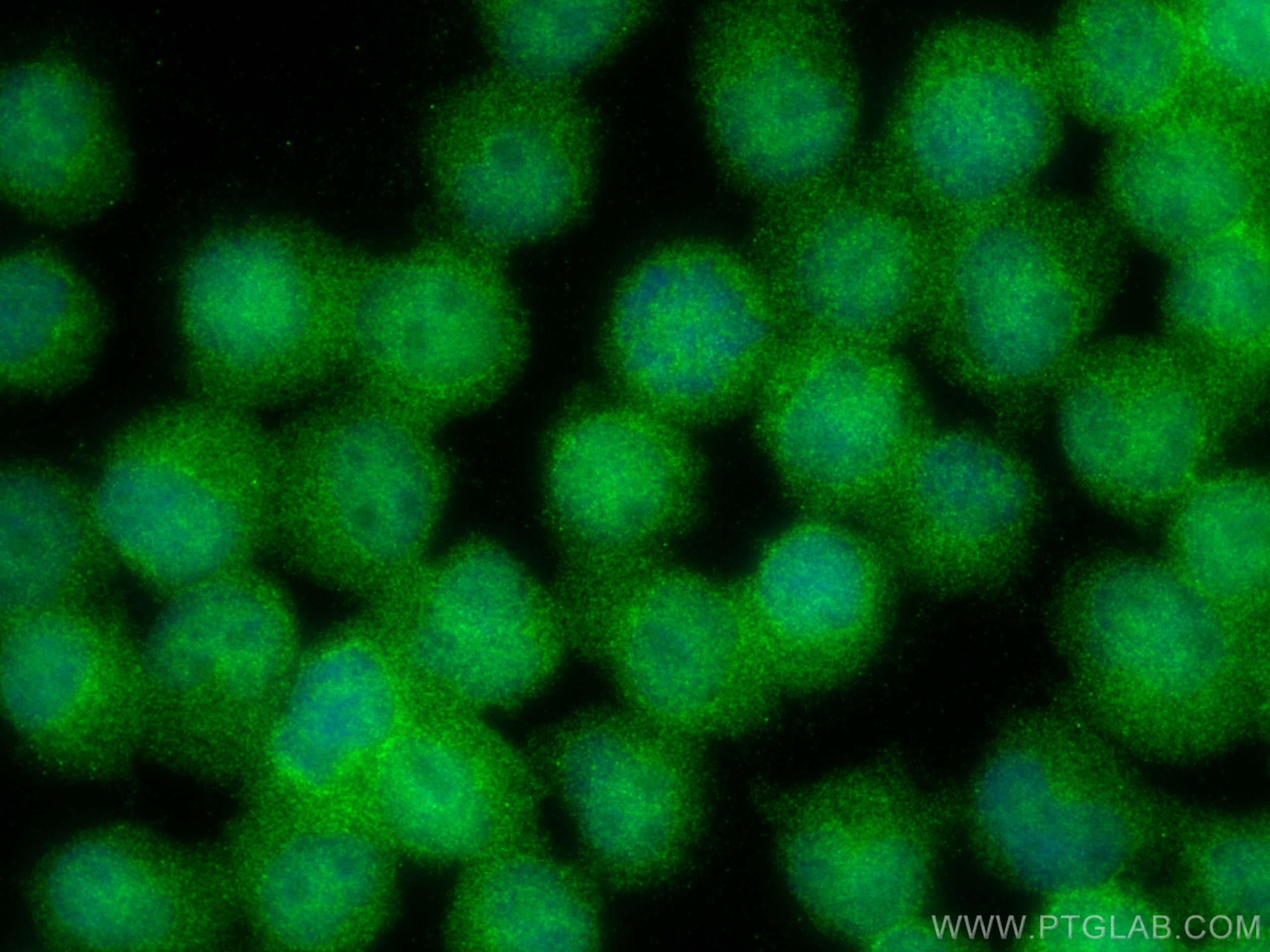 Immunofluorescence (IF) / fluorescent staining of Jurkat cells using JNK Recombinant antibody (81629-1-RR)