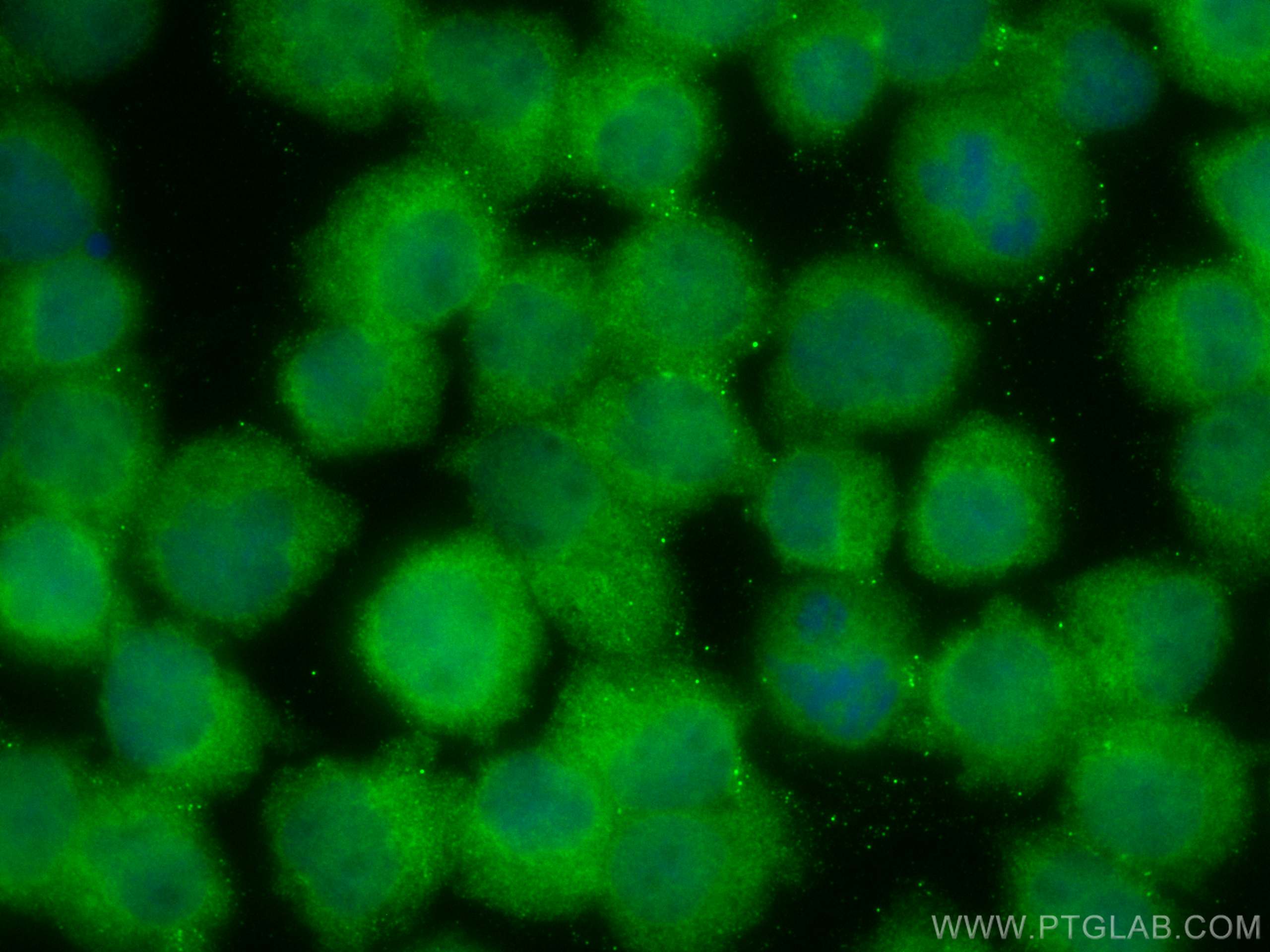 Immunofluorescence (IF) / fluorescent staining of Jurkat cells using CoraLite® Plus 488-conjugated JNK Polyclonal antib (CL488-24164)
