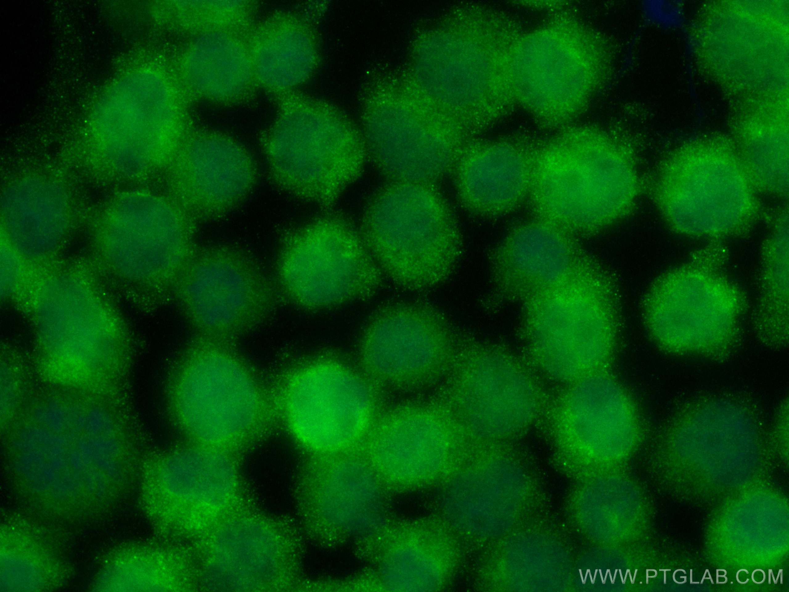 IF Staining of Jurkat using CL488-81629