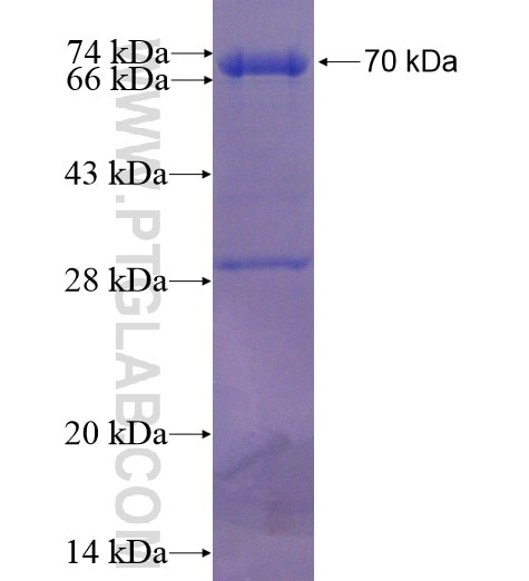 JP45; JSRP1 fusion protein Ag1300 SDS-PAGE