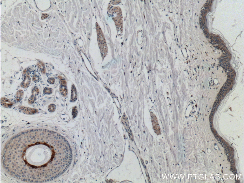 Immunohistochemistry (IHC) staining of human skin tissue using JPH1 Polyclonal antibody (25979-1-AP)