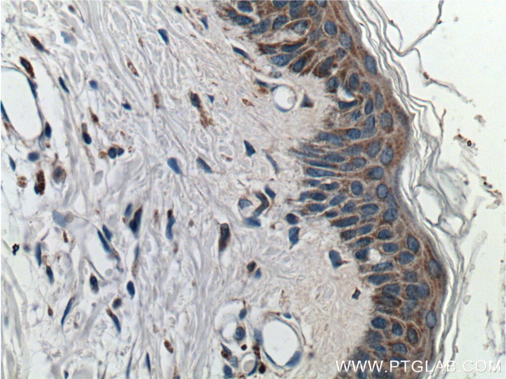 Immunohistochemistry (IHC) staining of human skin tissue using JPH1 Polyclonal antibody (25979-1-AP)