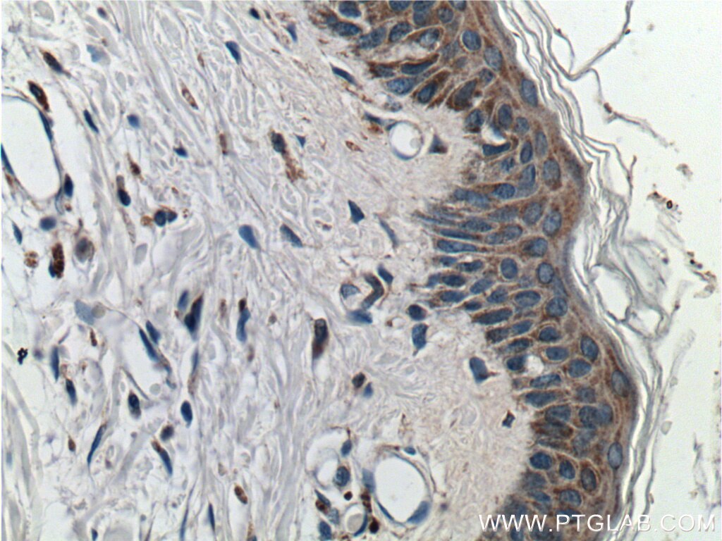 IHC staining of human skin using 25979-1-AP