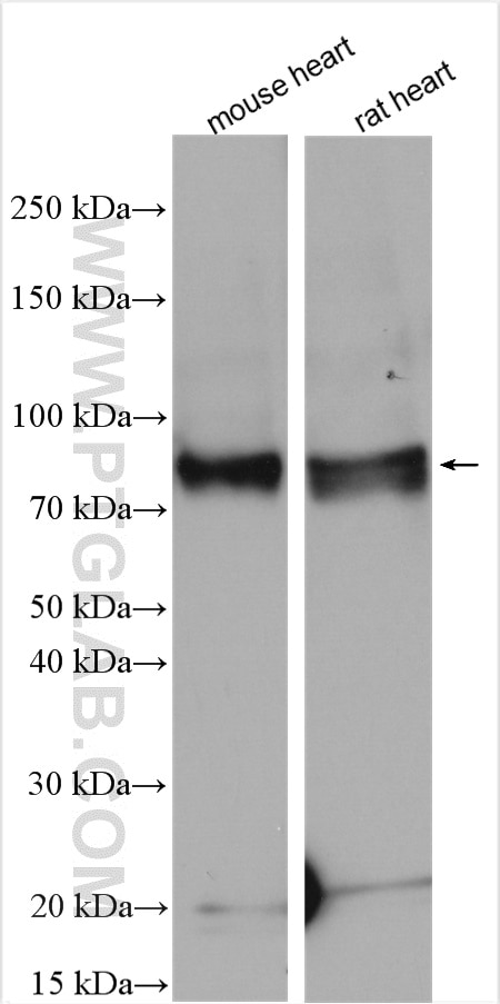 Western Blot (WB) analysis of various lysates using JPH1 Polyclonal antibody (25979-1-AP)