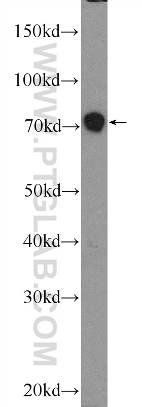 Western Blot (WB) analysis of HEK-293 cells using JPH1 Polyclonal antibody (25979-1-AP)