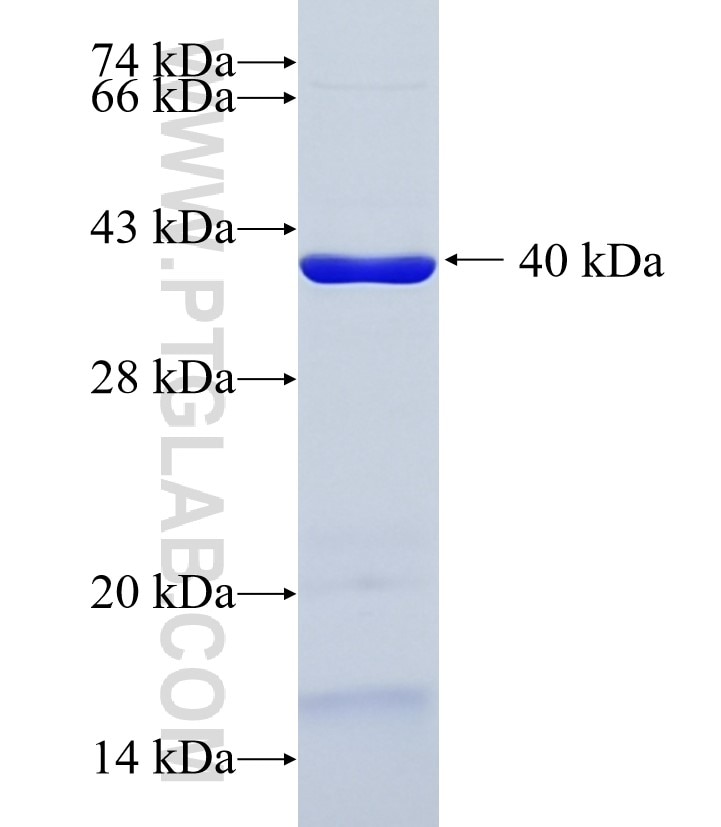 JPH2 fusion protein Ag36335 SDS-PAGE