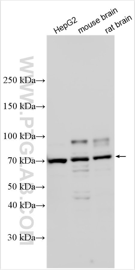 Western Blot (WB) analysis of various lysates using JPH4 Polyclonal antibody (32471-1-AP)