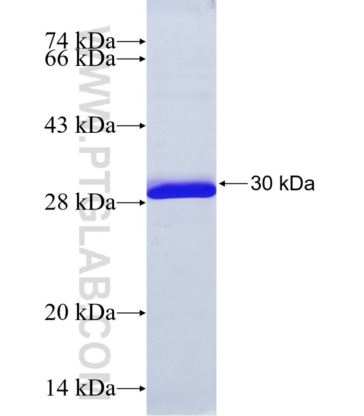 JPH4 fusion protein Ag38398 SDS-PAGE JPH4 fusion protein Ag38398 SDS-PAGE