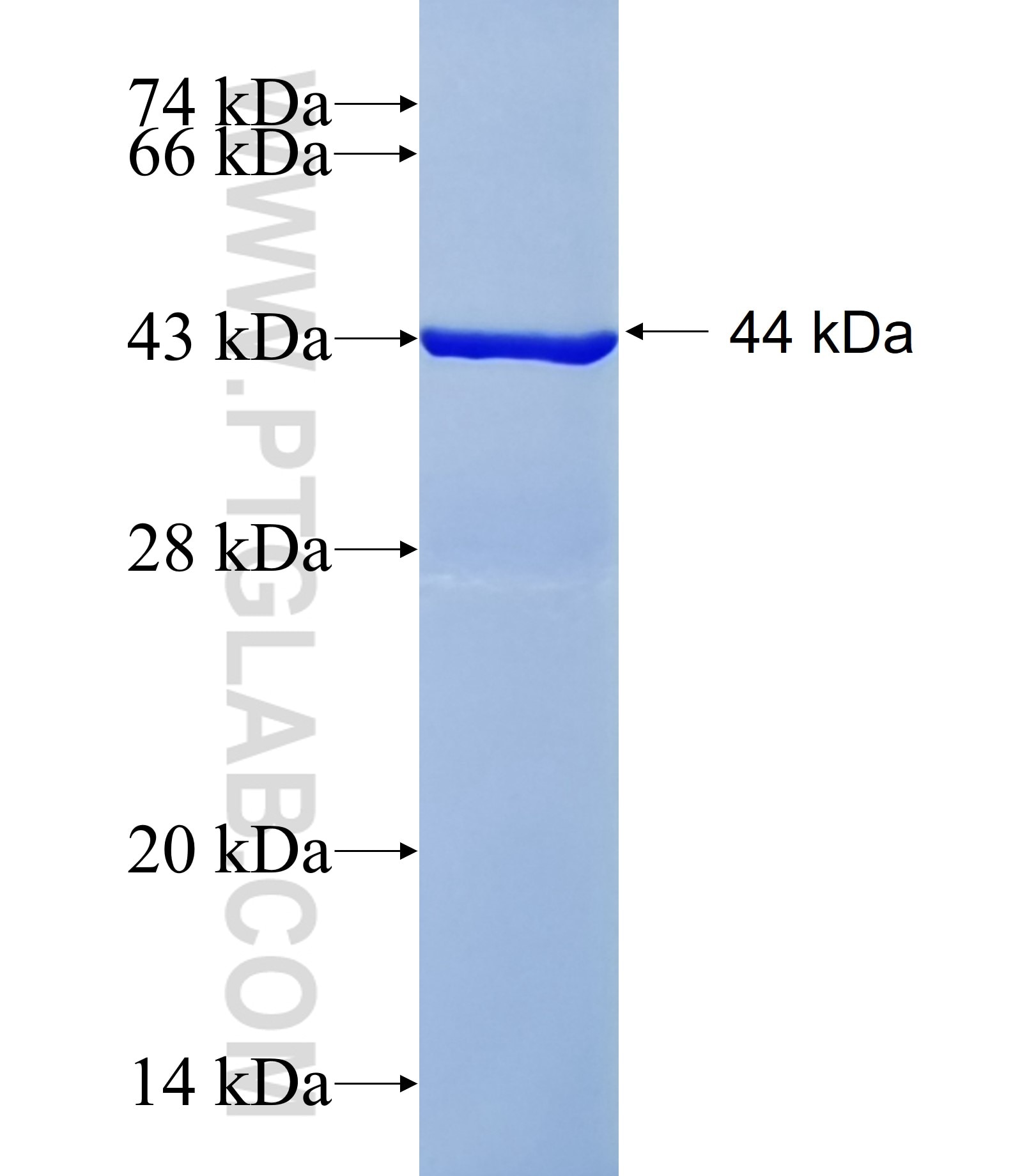 JRK fusion protein Ag38540 SDS-PAGE JRK fusion protein Ag38540 SDS-PAGE
