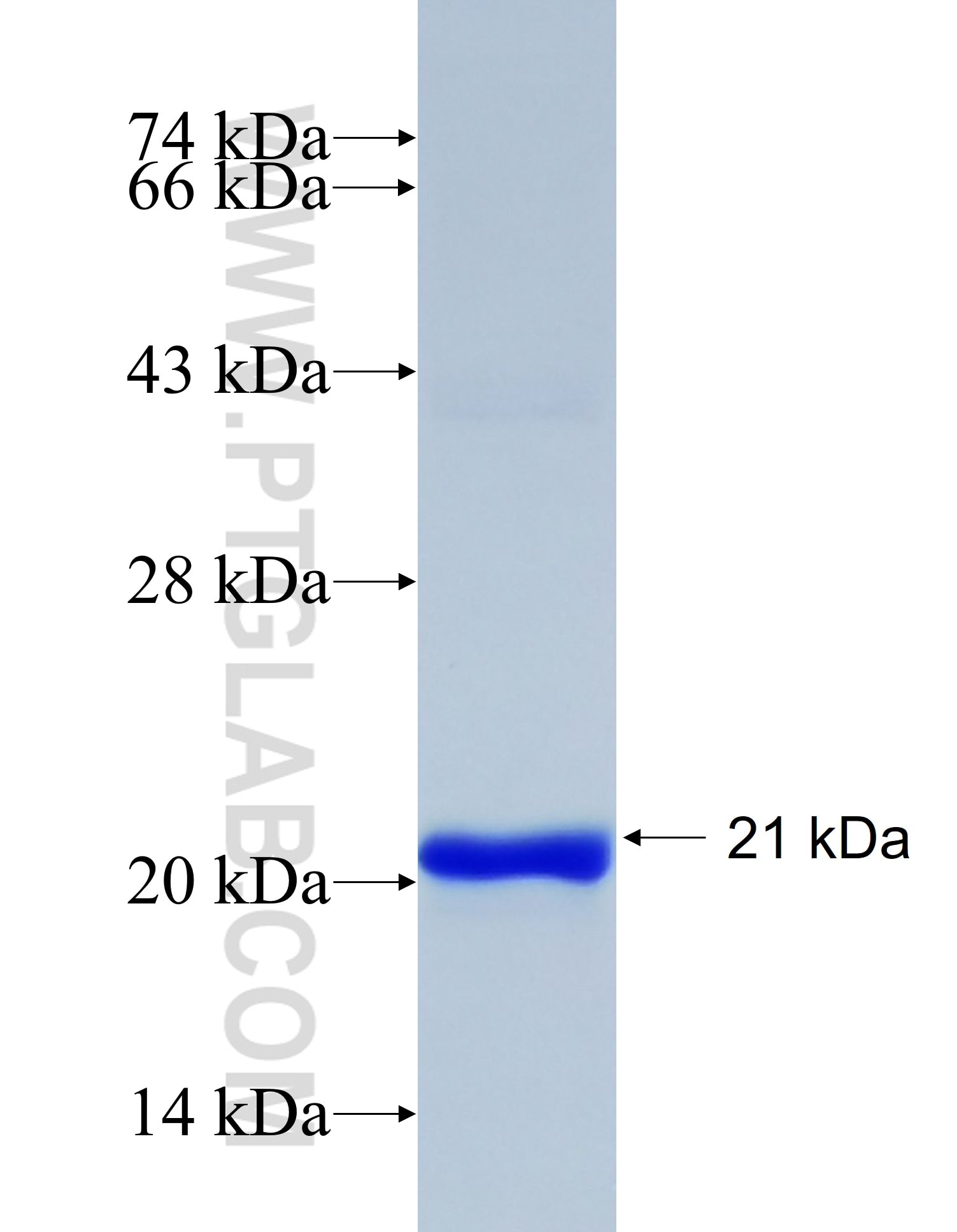 JRK fusion protein Ag38558 SDS-PAGE