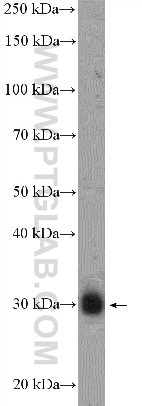 WB analysis of human skeletal muscle using 10854-1-AP