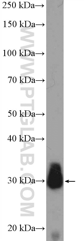 Western Blot (WB) analysis of human skeletal muscle tissue using JP45/JSRP1 Polyclonal antibody (10854-1-AP)