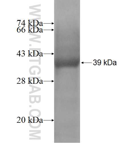 JTB fusion protein Ag0744 SDS-PAGE