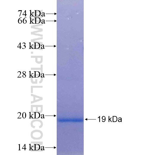 JTB fusion protein Ag13164 SDS-PAGE