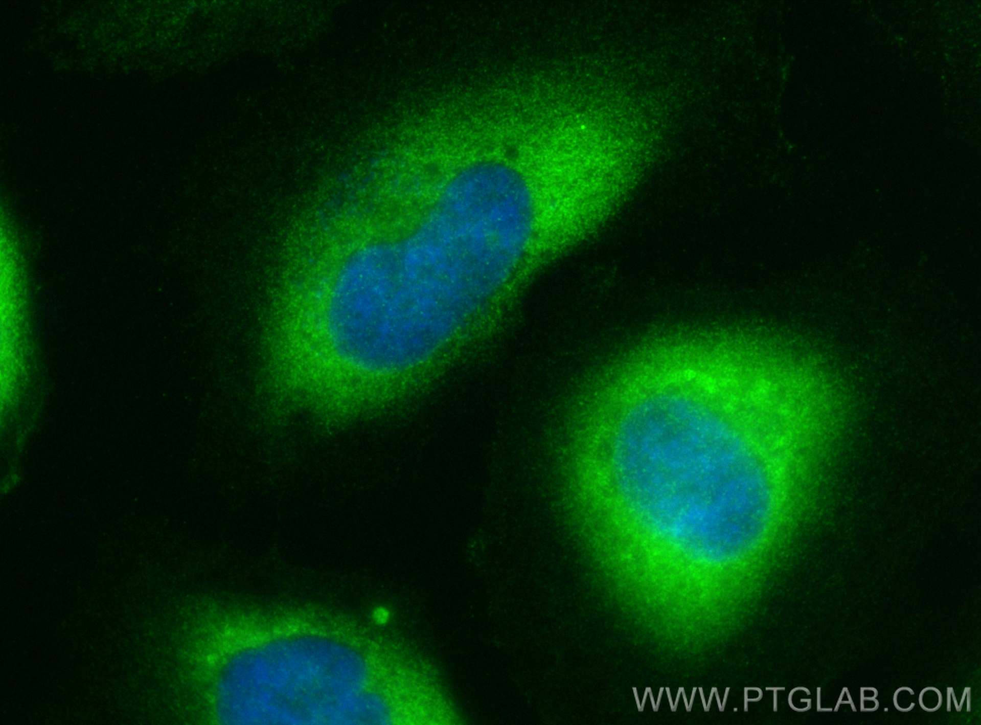 Immunofluorescence (IF) / fluorescent staining of HeLa cells using JTV1 Polyclonal antibody (10424-1-AP)