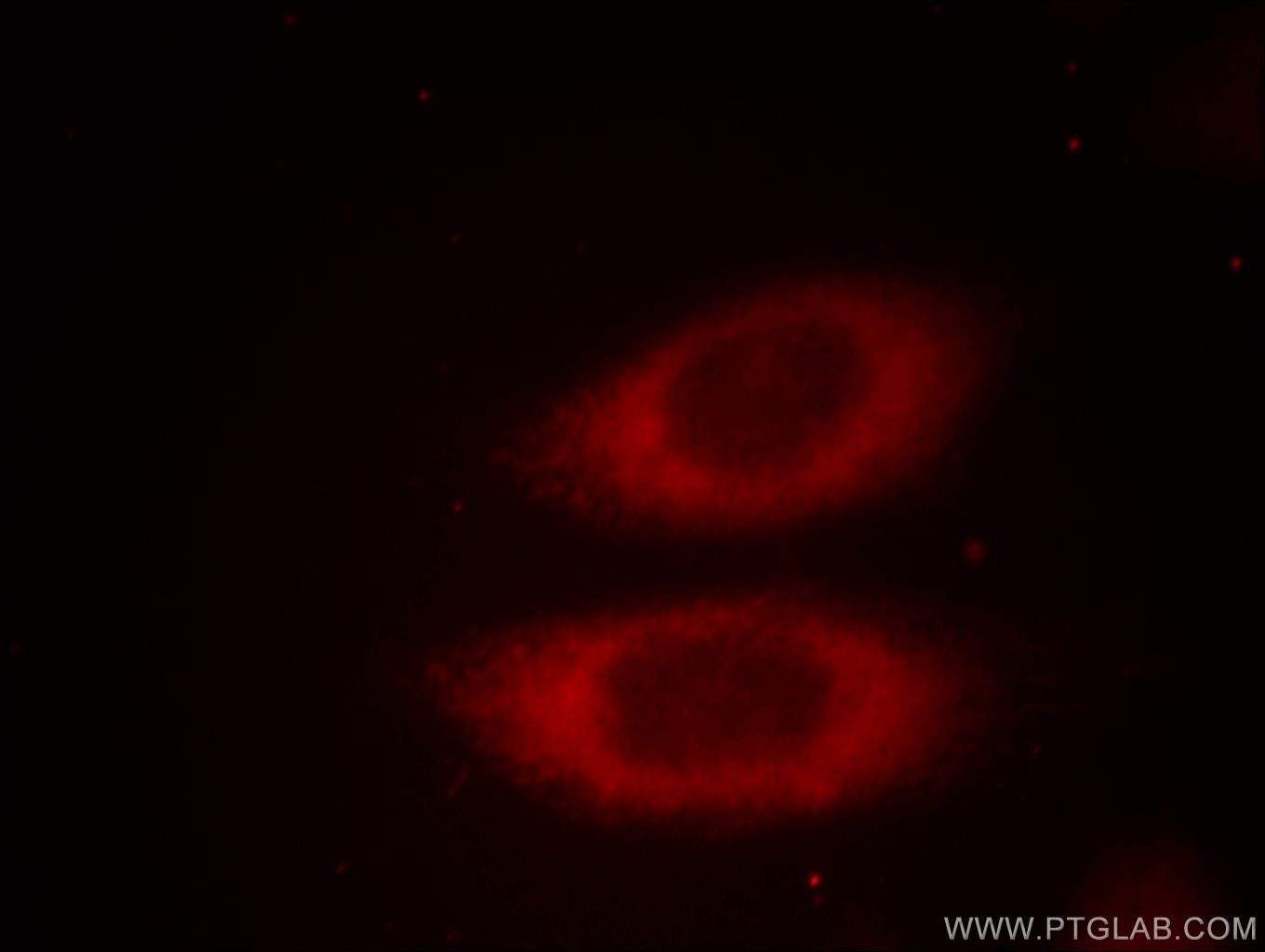 Immunofluorescence (IF) / fluorescent staining of HeLa cells using JTV1 Polyclonal antibody (10424-1-AP)