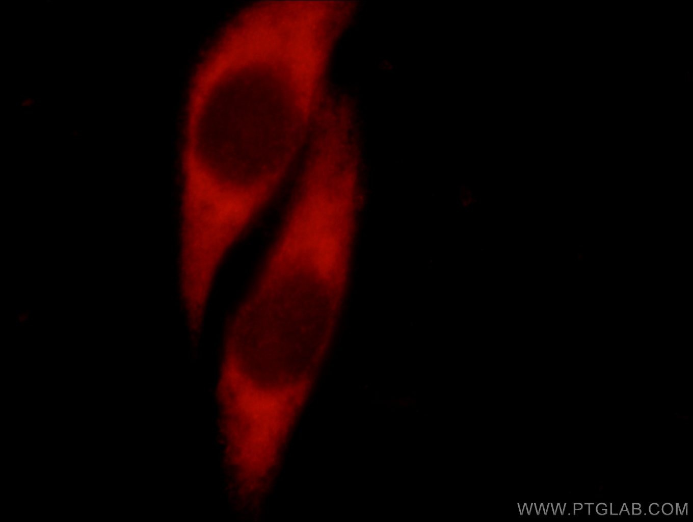 Immunofluorescence (IF) / fluorescent staining of HepG2 cells using JTV1 Polyclonal antibody (10424-1-AP)