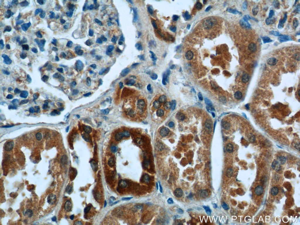 Immunohistochemistry (IHC) staining of human kidney tissue using JTV1 Polyclonal antibody (10424-1-AP)
