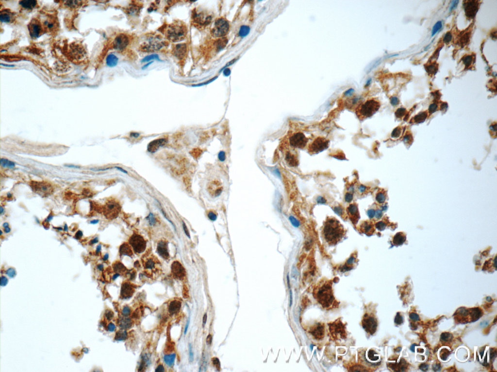 Immunohistochemistry (IHC) staining of human testis tissue using JTV1 Polyclonal antibody (10424-1-AP)