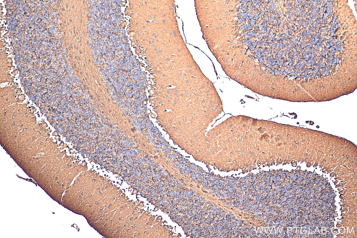 Immunohistochemistry (IHC) staining of mouse cerebellum tissue using JTV1 Polyclonal antibody (10424-1-AP)