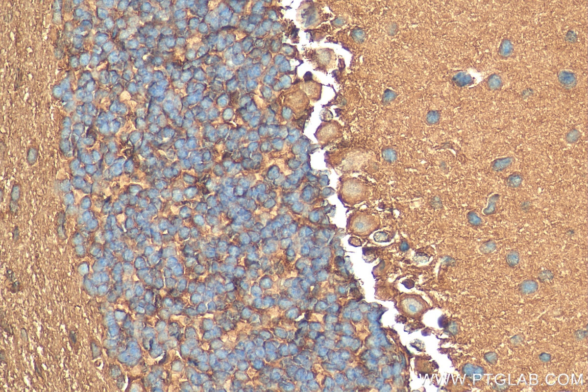 Immunohistochemistry (IHC) staining of mouse cerebellum tissue using JTV1 Polyclonal antibody (10424-1-AP)