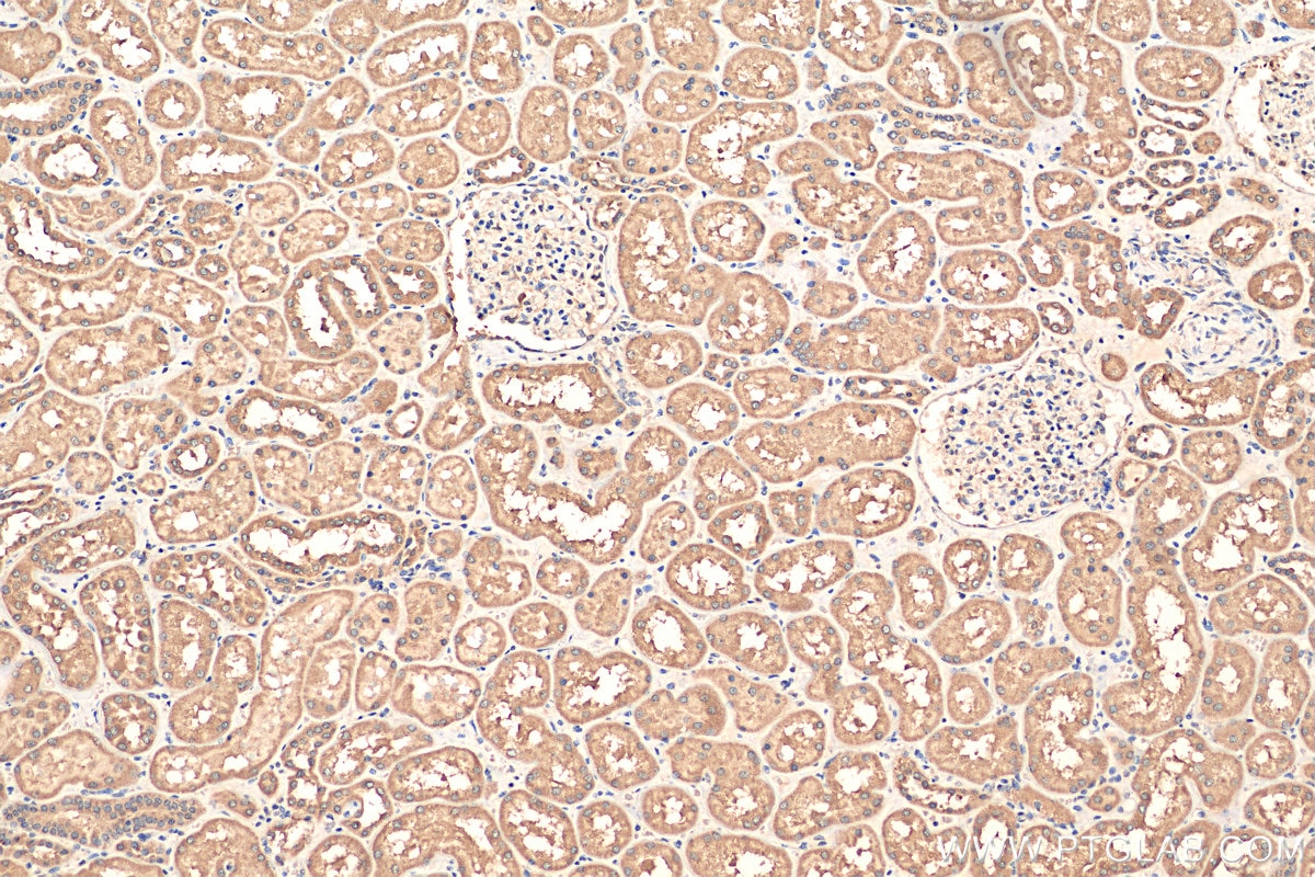 Immunohistochemistry (IHC) staining of human kidney tissue using JTV1 Polyclonal antibody (10424-1-AP)