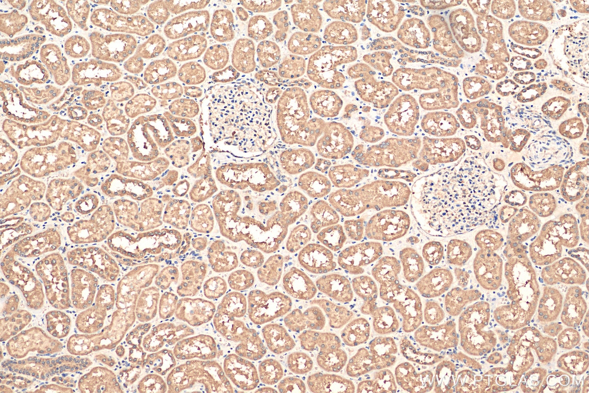 IHC staining of human kidney using 10424-1-AP