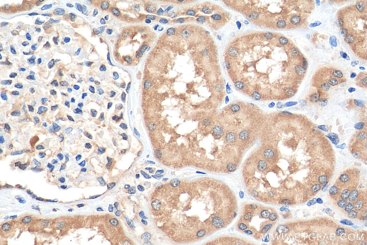 Immunohistochemistry (IHC) staining of human kidney tissue using JTV1 Polyclonal antibody (10424-1-AP)