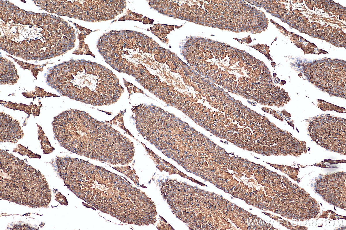 Immunohistochemistry (IHC) staining of mouse testis tissue using JTV1 Polyclonal antibody (10424-1-AP)