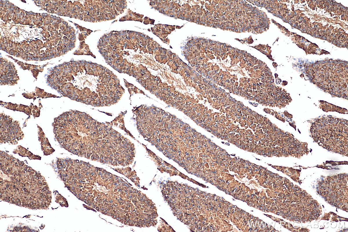 IHC staining of mouse testis using 10424-1-AP