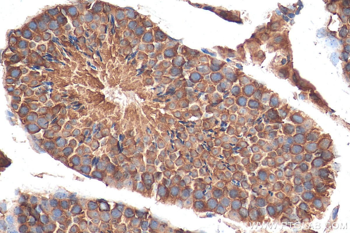 Immunohistochemistry (IHC) staining of mouse testis tissue using JTV1 Polyclonal antibody (10424-1-AP)