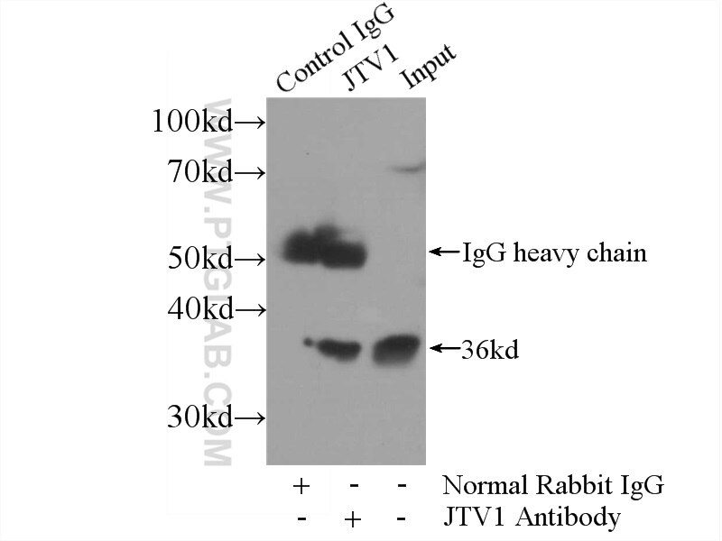 Immunoprecipitation (IP) experiment of HeLa cells using JTV1 Polyclonal antibody (10424-1-AP)