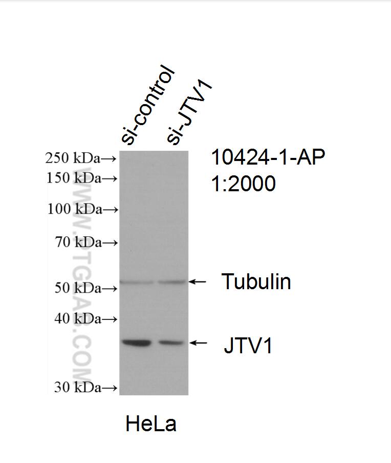 Western Blot (WB) analysis of HeLa cells using JTV1 Polyclonal antibody (10424-1-AP)