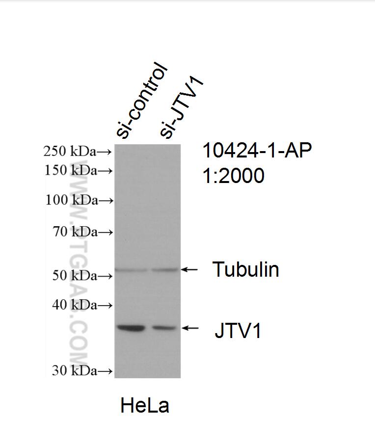 WB analysis of HeLa using 10424-1-AP