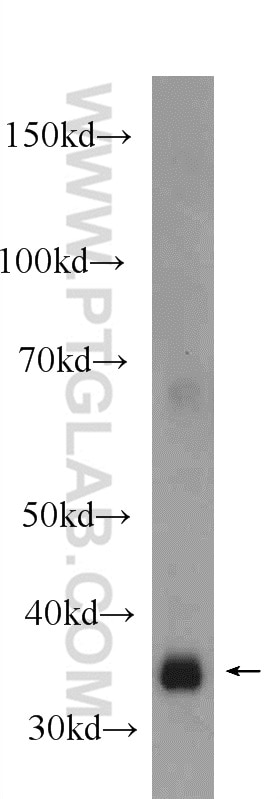 Western Blot (WB) analysis of rat liver tissue using JTV1 Polyclonal antibody (10424-1-AP)