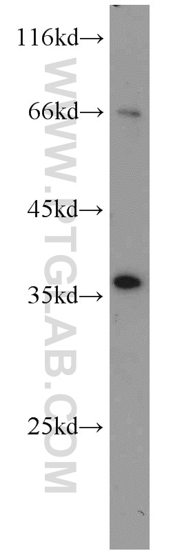 Western Blot (WB) analysis of HepG2 cells using JTV1 Polyclonal antibody (10424-1-AP)