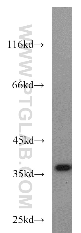 Western Blot (WB) analysis of HeLa cells using JTV1 Polyclonal antibody (10424-1-AP)