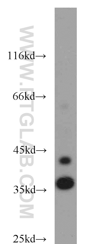 Western Blot (WB) analysis of K-562 cells using JTV1 Polyclonal antibody (10424-1-AP)