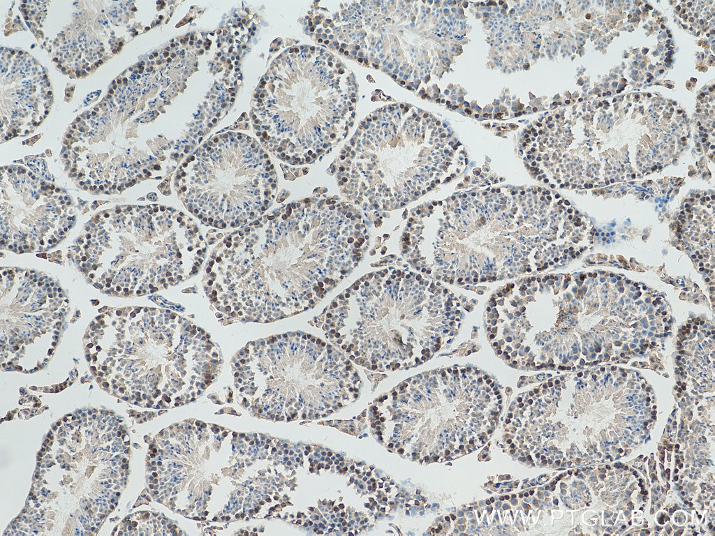 Immunohistochemistry (IHC) staining of mouse testis tissue using JTV1 Monoclonal antibody (66848-1-Ig)