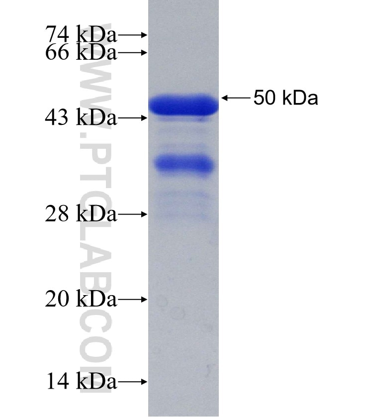 JUB fusion protein Ag29725 SDS-PAGE
