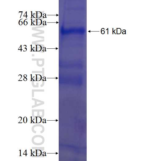 JUB fusion protein Ag1011 SDS-PAGE