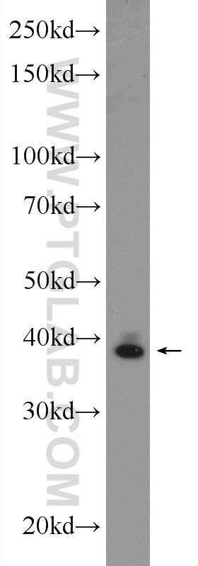 JUN Polyclonal antibody