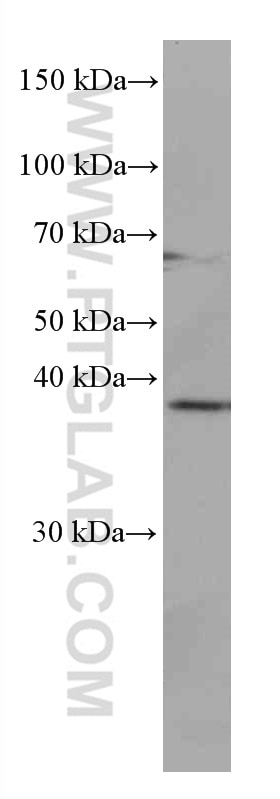 Western Blot (WB) analysis of Jurkat cells using JUN Monoclonal antibody (66313-1-Ig)