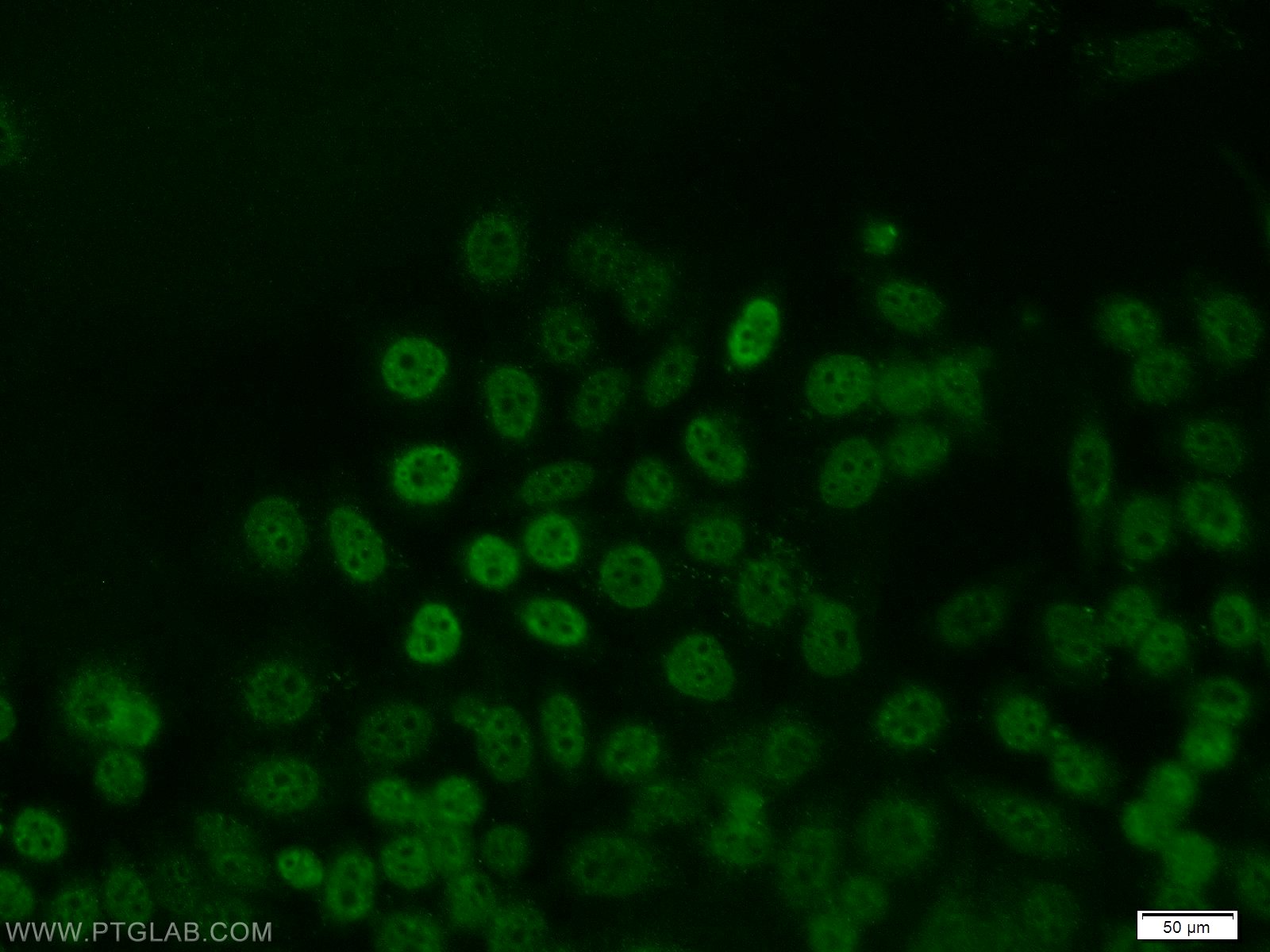 Immunofluorescence (IF) / fluorescent staining of MCF-7 cells using JUNB Polyclonal antibody (10486-1-AP)