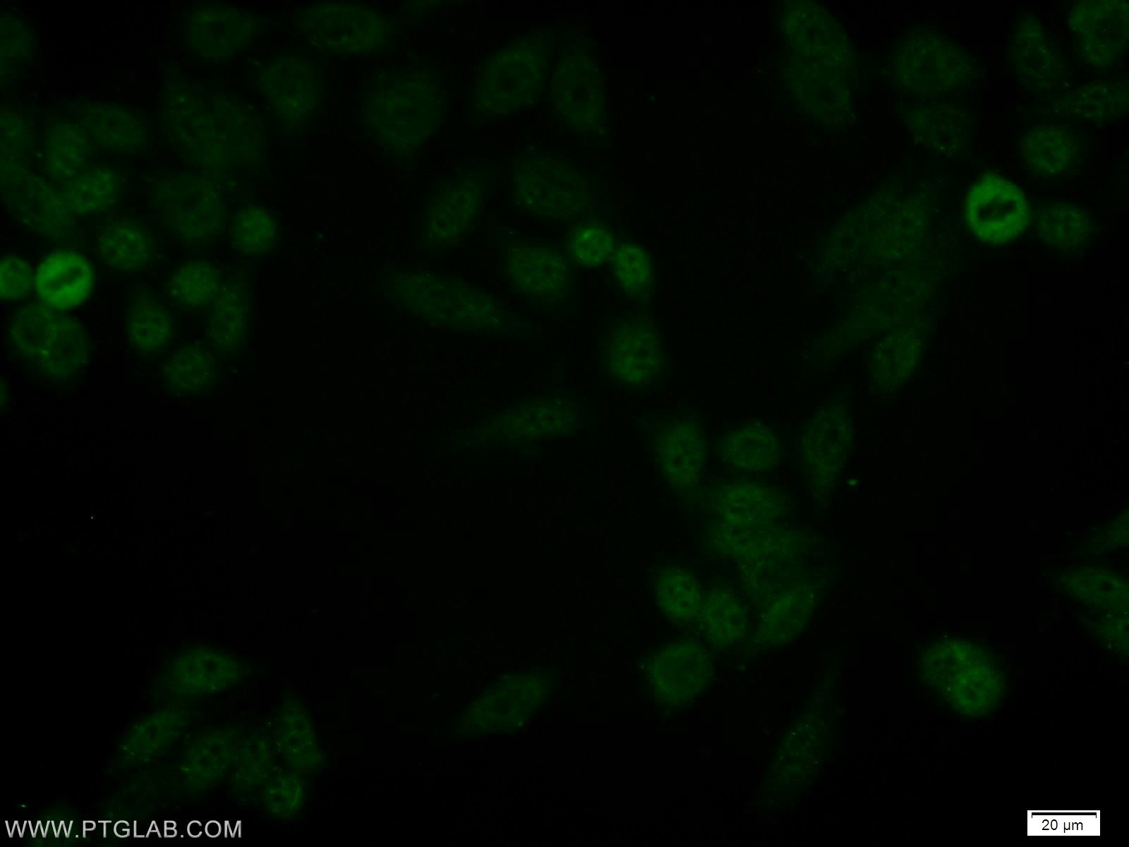 Immunofluorescence (IF) / fluorescent staining of HeLa cells using JUNB Polyclonal antibody (10486-1-AP)