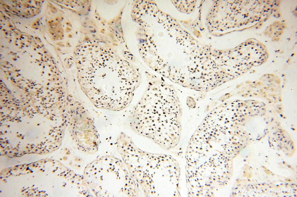 Immunohistochemistry (IHC) staining of human testis tissue using JUNB Polyclonal antibody (10486-1-AP)